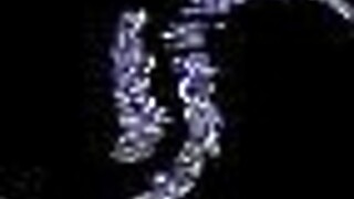 teen in stockings pics collection