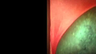 Redhead gets her pussy filled with hot cum inside