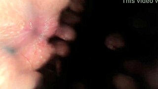 Girl Worries Heavily Pigmented Anal Looks Dirty When Clean