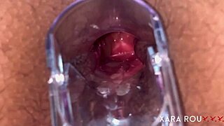 Anal Vision Speculum Gaping Huge Hairy Ass In Mature Homemade Action