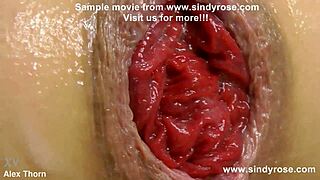 Sindy Rose Prolapses from Extreme Anal Fisting