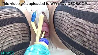 See Bottles Hanging from Prolapsed Cervix Extreme?
